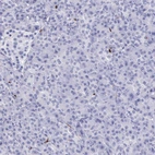 Immunohistochemical staining of human pancreas shows no positivity in exocrine glandular cells as expected.