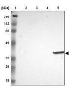 Lane 1: Marker [kDa] 219, 112, 85, 49, 32, 25, 18_br/_Lane 2: Human cell line RT-4_br/_Lane 3: Human cell line U-251MG sp_br/_Lane 4: Human cell line A-431_br/_Lane 5: Human liver tissue