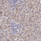 Immunohistochemical staining of human Liver shows moderate cytoplasmic positivity in hepatocytes.