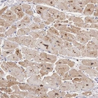 Immunohistochemical staining of human Heart muscle shows moderate cytoplasmic positivity in cardiomyocytes.