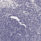 Anti-NINL Antibody