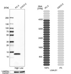 Anti-LGALS1 Antibody