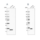 Western blot analysis using Anti-LGALS1 antibody HPA000687 (A) shows similar pattern to independent antibody HPA000646 (B).
