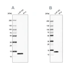 Western blot analysis using Anti-LGALS1 antibody HPA000687 (A) shows similar pattern to independent antibody HPA000646 (B).