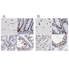 Anti-SF3A1 Antibody