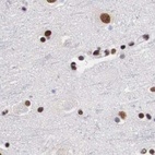 Anti-SF3A1 Antibody