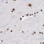 Immunohistochemical staining of human cerebral cortex using Anti-SF3A1 antibody HPA000690.