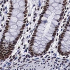 Immunohistochemical staining of human colon using Anti-SF3A1 antibody HPA000690.