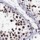 Immunohistochemical staining of human testis using Anti-SF3A1 antibody HPA000690.