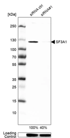 Western blot analysis in U-251MG cells transfected with control siRNA, target specific siRNA probe #1, using Anti-SF3A1 antibody. Remaining relative intensity is presented. Loading control: Anti-GAPDH.