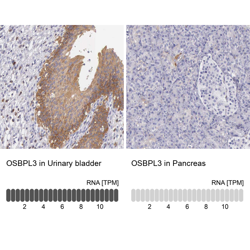Anti-OSBPL3 Antibody