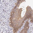 Anti-OSBPL3 Antibody