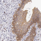 Immunohistochemical staining of human urinary bladder shows high expression.