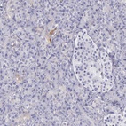 Anti-OSBPL3 Antibody