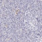 Immunohistochemical staining of human pancreas shows low expression as expected.