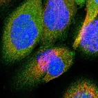 Immunofluorescent staining of human cell line A-431 shows localization to nucleoli & cytosol.