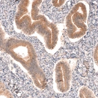 Anti-DICER1 Antibody