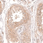Immunohistochemical staining of human testis shows moderate cytoplasmic positivity in cells in seminiferous ducts.