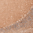 Immunohistochemical staining of human cerebellum shows moderate positivity in neuropil.