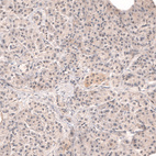 Anti-DICER1 Antibody