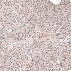 Immunohistochemical staining of human pancreas shows weak cytoplasmic positivity in islets of Langerhans, while exocrine cells are mainly negative.