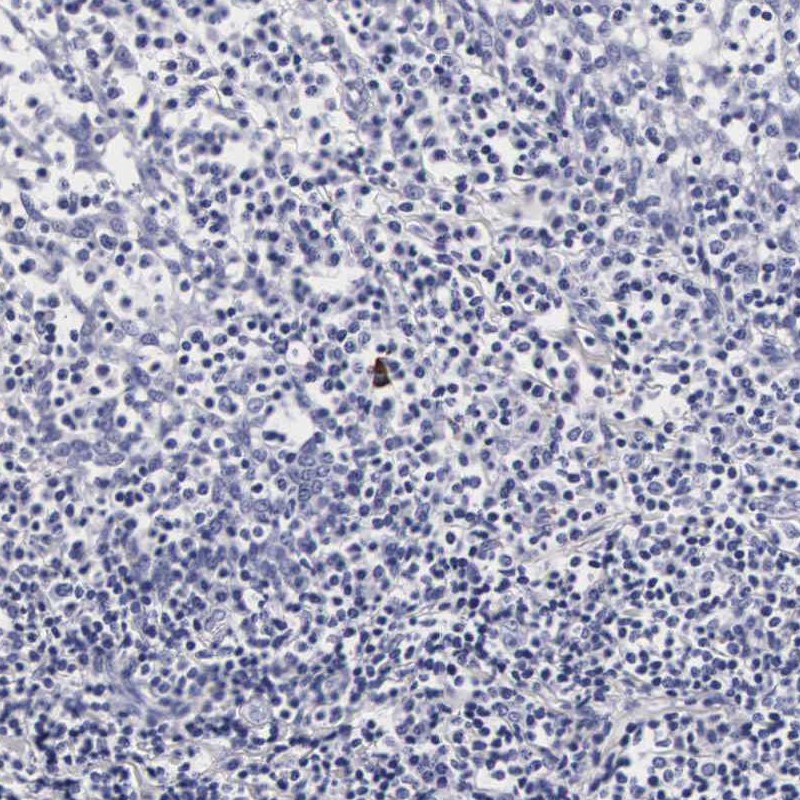 Anti-RNASE6 Antibody