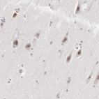 Anti-MNAT1 Antibody