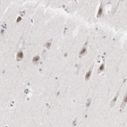 Immunohistochemical staining of human Cerebral cortex shows moderate nuclear positivity in neurons.