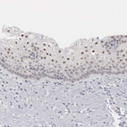 Immunohistochemical staining of human Cervix shows moderate nuclear positivity in squamous epithelial cells.