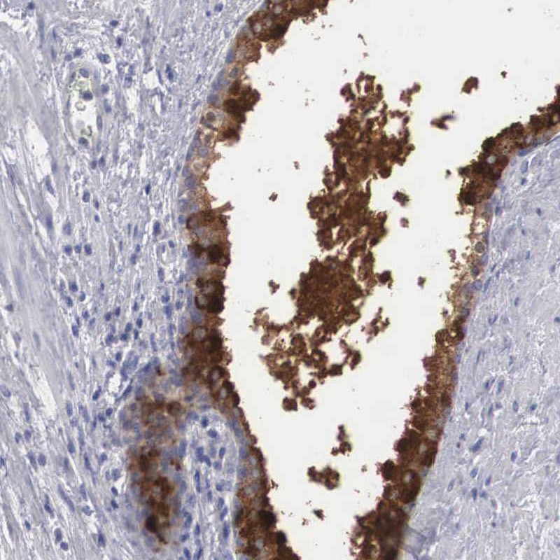 Anti-ZBTB42 Antibody