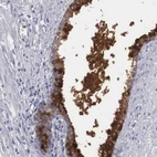 Anti-ZBTB42 Antibody