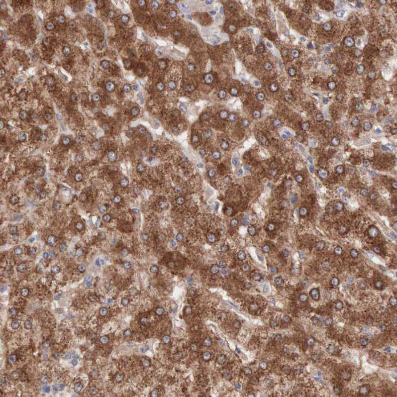 Anti-MTHFD1 Antibody