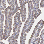 Immunohistochemical staining of human fallopian tube shows weak to moderate cytoplasmic positivity in glandular cells.