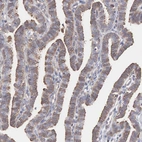 Immunohistochemical staining of human fallopian tube shows weak to moderate cytoplasmic positivity in glandular cells.