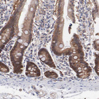 Anti-MTHFD1 Antibody