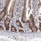 Immunohistochemical staining of human duodenum shows moderate to strong cytoplasmic positivity in glandular cells.