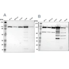 Western blot analysis using Anti-MTHFD1 antibody HPA000704 (A) shows similar pattern to independent antibody HPA001290 (B).
