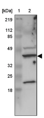 Lane 1: Marker [kDa] 219, 112, 85, 49, 32, 25, 18_br/_Lane 2: Human cell line RT-4