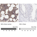 Anti-BID Antibody