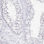 Immunohistochemical staining of human testis shows low expression as expected.