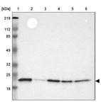 Lane 1: Marker [kDa] 219, 112, 85, 49, 32, 25, 18_br/_Lane 2: Human cell line RT-4_br/_Lane 3: Human cell line EFO-21_br/_Lane 4: Human cell line A-431_br/_Lane 5: Human liver tissue_br/_Lane 6: Human tonsil tissue