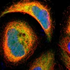 Immunofluorescent staining of human cell line A-431 shows localization to cytosol.
