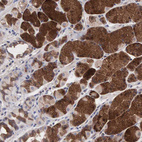 Anti-INF2 Antibody