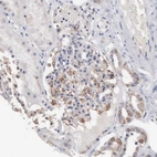 Immunohistochemical staining of human kidney shows moderate cytoplasmic positivity in podocytes and cells in tubules.