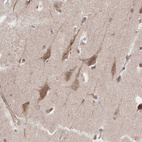 Immunohistochemical staining of human cerebral cortex shows moderate cytoplasmic positivity in neurons.