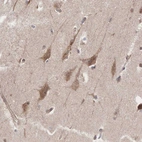 Immunohistochemical staining of human cerebral cortex shows moderate cytoplasmic positivity in neurons.