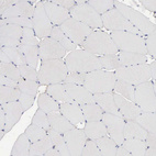 Immunohistochemical staining of human skeletal muscle shows no cytoplasmic positivity in striated muscle fibers.