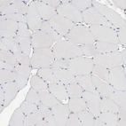 Immunohistochemical staining of human skeletal muscle shows no cytoplasmic positivity in striated muscle fibers.