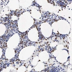 Immunohistochemical staining of human bone marrow shows moderate nuclear and cytoplasmic positivity in hematopoietic cells.