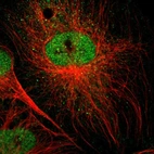 Immunofluorescent staining of human cell line U-251 MG shows localization to nucleoplasm.